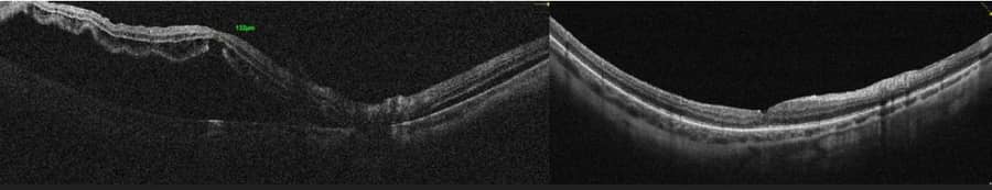 Slider image (9) Dr Nikolaos I Dervenis Eye Clinic